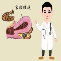 求子路上的绊脚石宫腔粘连到底是什么怎么破 