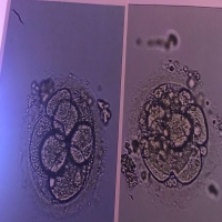 揭秘试管婴儿中的鲜胚：特点、优势及全过程解析