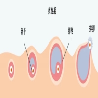 试管前制定科学改善卵子质量的有效计划？