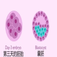 笙宝谈试管婴儿中的养囊：详解过程、作用和优势