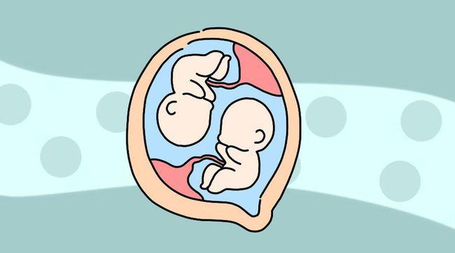 试管婴儿移植单胎还是双胎好？ 图一